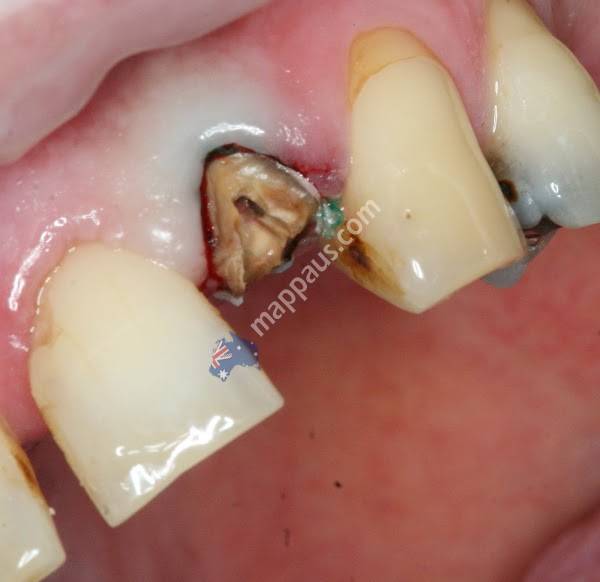 Piopio Dental